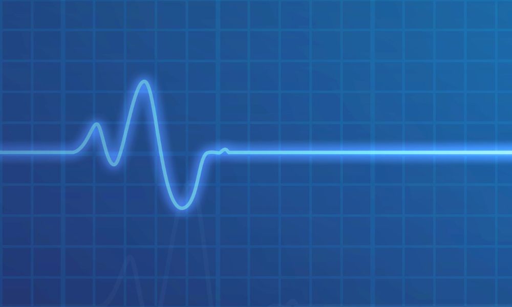 One Way To Call A Code Blue In A Hospital One Way To Call A Code Blue In A Hospital