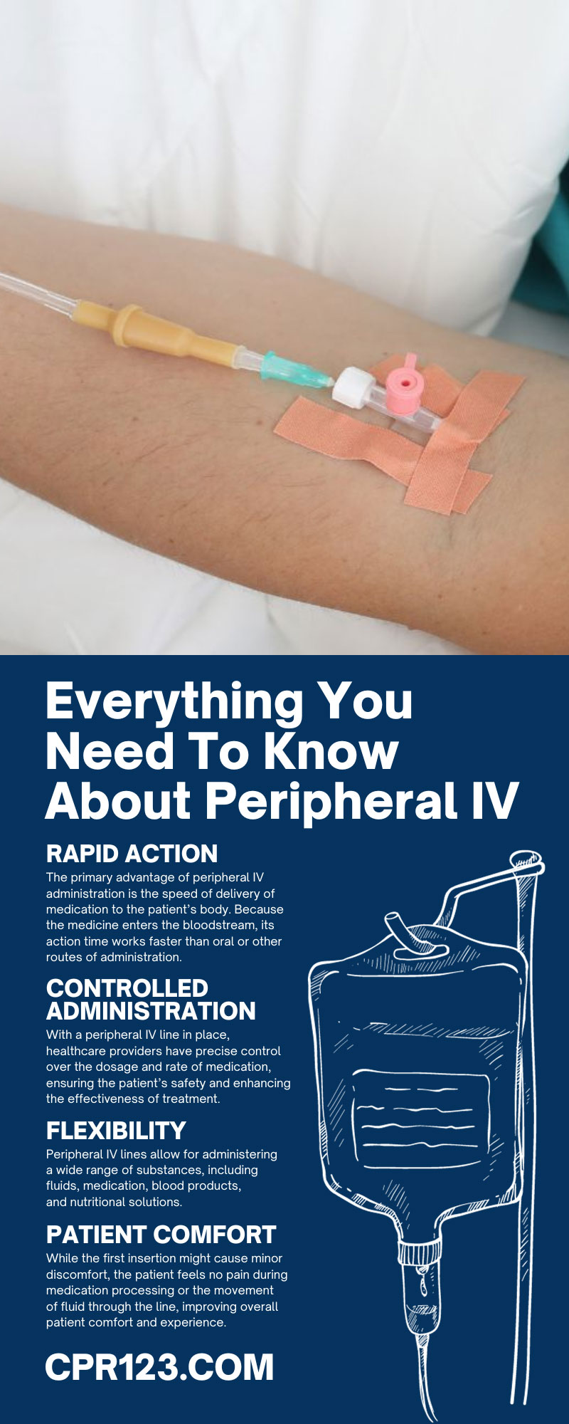 Everything You Need To Know About Peripheral IV
