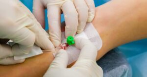 Gloved healthcare workers perform a peripheral IV insertion in a patient’s arm, securing a catheter with gauze and adhesive.