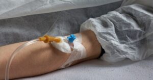 A patient’s forearm with a secured peripheral IV catheter and tubing taped in place during hospital treatment.