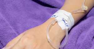 A patient’s hand with a secured IV catheter and tubing, demonstrating proper placement for intravenous fluid administration.
